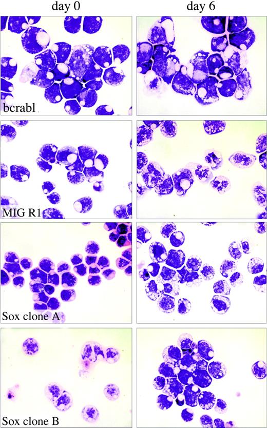 Figure 4. Analysis of the effects of Sox4 on myeloid cell differentiation. Single-cell-derived 32Dwt18 clones (MIGR1-Bcr-abl, MIGR1, MIGR1-Sox4 Clone A, MIGR1-Sox4 Clone C) were treated to differentiate in the presence of Epo (6 U/mL). Prior to treatment with Epo, a fraction of the culture was harvested and washed with PBS, and cytospin preparations were made. The rest of the culture was washed with PBS and replaced in media containing Epo and lacking IL-3. Each culture was refed every 48 hours. At day 6, samples of the cells were washed with PBS, and cytospin preparations were made. Slides were stained with Wright-Giemsa stain and analyzed by light microscopy to visualize morphologic changes. Images were acquired digitally on an Olympus Vanox microscopes (Olympus, Tokyo, Japan) equipped with a SPIano 100× oil immersion lens (NA = 1.40) and a ProgRes camera (Kontron America, Poway, CA) using AutoCyte image-capture software (AutoCyte, Burlington, NC). Images were cropped and assembled using Adobe Photoshop (Adobe, San Jose, CA).