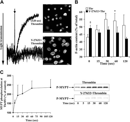 Figure 1. The Rho kinase inhibitor Y-27632 inhibits shape change, F-actin increase, and MYPT phosphorylation induced by thrombin. Platelets were incubated with Y-27632 (20 μM) or solvent (H2O) for 30 minutes and then stimulated by thrombin (0.075 U/mL). (A) Inhibition of shape change by Y-27632. Shape change was measured by the decrease in light transmission, (left) and by confocal fluorescence microscopy of platelets stained for F-actin with Alexa Fluor 546 phalloidin (right). Bar, 10 μm. (B) Effect of Y-27632 on F-actin content during shape change. Values are mean + SD of 4 independent experiments. *Statistically significant; P < .05 with respect to time (0 seconds). †Significance between control (□) and Y-27632 (▪)–treated unstimulated platelets. (C, left) Platelet lysates were immunoblotted with anti–phospho-Thr853-MYPT antibody. Graphic representation of the result of MYPT phosphorylation in thrombin (0.075 U/mL)–stimulated platelets, evaluated by densitometry. Values are mean + SD of 3 experiments with platelets from different donors. (Right) Representative Western blot of MYPT phosphorylation in the absence and presence of Y-27632.