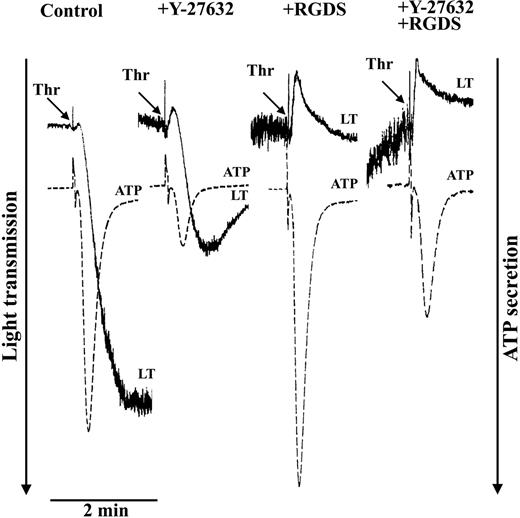Figure 4. Inhibition of thrombin-induced aggregation and secretion by the Rho kinase inhibitor Y-27632. Platelets were stimulated with thrombin (0.5 U/mL) in the absence or presence of the integrin αIIbβ3 blocker RGDS (0.5 mM) and the Rho kinase inhibitor Y-27632 (20 μM). Representative tracings for change in light transmission (LT) and ATP secretion are shown.