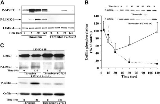 Figure 6. Inhibition of MYPT phosphorylation, LIMK-1 phosphorylation, LIMK-1 activity, and cofilin rephosphorylation by the Rho kinase inhibitor Y-27632 during thrombin-stimulated aggregation/secretion. Platelet samples stimulated by thrombin (0.5 U/mL) in the absence or presence of the Rho kinase inhibitor Y-27632 (20 μM) were immunoblotted with anti–phospho-MYPT, anti–phospho-LIMK-1/LIMK-2 (Thr508/505), and anti–phospho-cofilin antibodies. (A) Representative immunoblots showing concomitant inhibition of MYPT and LIMK-1 phosphorylation by Y-27632. (B) Immunoblot and graphic representation of the results of cofilin phosphorylation after thrombin stimulation of platelets in the absence (□) or presence of Y-27632 (▪). Values are mean + SD for 3 independent experiments. (C) LIMK-1 phosphorylation parallels LIMK-1 activity in thrombin-stimulated platelets. Inhibition by Y-27632. Platelets were preincubated with Y-27632 (20 μM) or solvent for 30 minutes and stimulated with thrombin in the presence of RGDS. LIMK-1 from resting and activated platelets (120 seconds) was immunoprecipitated. (Top) LIMK-1 immunoprecipitates (LIMK-1 IP) were blotted with anti–LIMK-1 antibody and anti–phospho-LIMK-1/LIMK-2 (Thr508/505) antibody. (Bottom) Immunoprecipitates were assayed for LIMK-1 activity using His-cofilin as substrate. Cofilin phosphorylation was measured by blotting the samples with anti–phospho-cofilin antibodies.
