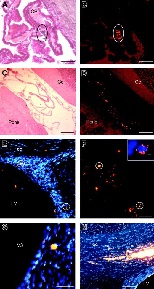 Figure 2. Traffic of microsphere-loaded DCs in the CNS of normal rats. DCs were incubated for 24 hours with fluorescent microspheres, then washed and injected into the CSF (A-G) or brain parenchyma (H) of normal rats. Photomicrographs show representative results obtained from analyses of brains on day 3 after injections. (A-D) Brain sections were examined by light microscopy after hematein-eosin staining (A,C) or by fluorescent microscopy to detect cells loaded with fluorescent beads (red) (B,D). Groups of labeled cells are detected in the lateral ventricle, homolateral to the injection site, on the apical surface of the choroid plexus (A-B; circle). Injected DCs are detected bilaterally in the recesses of the fourth ventricle (C-D). (E-G) For the detection of cells loaded with red fluorescent beads, brain sections were examined by fluorescence microscopy after counterstaining with DAPI for nuclei visualization (blue). Cells loaded with fluorescent beads are observed in the subventricular zone homolateral to intravenous injection and particularly within the germinal zone (E-F; circles). Inset in panel F shows a high magnification view of a cell located in the germinal zone and harboring numerous intracytoplasmic beads. Photomicrograph in panel G shows a cell containing fluorescent beads in brain parenchyma adjacent to the third ventricle. (H) DCs loaded with fluorescent microspheres and injected into the corpus callosum migrate a short distance from the injection site, along the adjacent white matter tracts. LV indicates lateral ventricle; cc, corpus callosum; CP, choroid plexus; Ce, cerebellum; V3, third ventricle. Scale bars: 200 μm (C,D,H), 100 μm (A,B,E,F), 50 μm (G), 2 μm (inset in panel F).