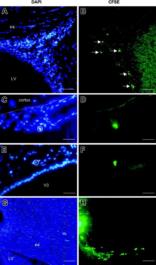 Figure 3. Traffic of CFSE-labeled DCs in the CNS of normal rats. Bone marrow-derived DCs labeled with CFSE were injected into the CSF (A-F) or brain parenchyma (G-H) of normal rats. For the detection of green CFSE-labeled cells, brain sections were examined by fluorescence microscopy after counterstaining with DAPI for nuclei visualization (blue). Photomicrographs show representative results obtained from analyses of brains on day 3 after injections. (A-B) CFSE-labeled cells (white arrows) are detected in the germinal zone homolateral to the injection site. (C-D) CFSE-labeled cells are detected in brain cortical meninges (white dotted line indicates localization of the glia limitans; circle indicates nuclei of CFSE-labeled cells). (E-F) A CFSE-labeled cell is observed in the brain parenchyma adjacent to the third ventricle (circle indicates the nucleus of the CFSE-labeled cell). (G-H) CFSE-labeled DCs injected into the corpus callosum migrate a short distance from the injection site, along the adjacent white matter tracts. LV indicates lateral ventricle; cc, corpus callosum; V3, third ventricle. Scale bars: 100 μm (G-H), 50 μm (A-B), 30 μm (C-F).