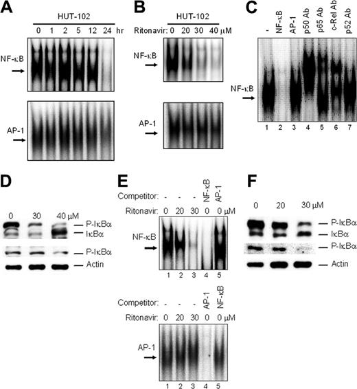 Figure 2. Ritonavir inhibits constitutive NF-κB activation. (A) HUT-102 cells treated with ritonavir (40 μM) for the indicated time were evaluated for NF-κB and AP-1 activation. (B) HUT-102 cells treated with the indicated concentration of ritonavir for 24 hours were evaluated for NF-κB and AP-1 activation. (C) Cold competition using 100-fold molar excess of unlabeled NF-κB and AP-1 oligonucleotides (lanes 2 and 3) demonstrated the specificity of the protein/DNA binding complexes. Specificity of NF-κB binding was also determined by using antibodies to the NF-κB components p50, p65, c-Rel, and p52, resulting in supershift (lanes 4-7). (D) HUT-102 cells were treated with the indicated concentration of ritonavir for 24 hours, and cell lysates were immunoblotted for IκBα (top) and phospho-IκBα (middle). Actin immunoblots confirm that similar amounts of cell extracts were analyzed (bottom). (E) Primary acute-type ATL cells treated with concentrations of ritonavir as indicated for 24 hours were evaluated for NF-κB and AP-1 activation. Where indicated, 100-fold excess amounts of competitor oligonucleotides were added to the reaction mixture (lanes 4 and 5). (F) The bands of phosphorylated IκΒα were down-regulated by ritonavir treatment. Detection of actin expression was used as an internal control.