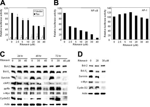 Figure 3. Ritonavir inhibits NF-κB transcriptional activation and expression of apoptosis- and cell-cycle-associated proteins. (A) Ritonavir inhibits Tax-induced NF-κB transcriptional activation. κB-LUC was transfected into Jurkat cells with Tax-expressing plasmid (▪) or empty vector (□). After transfection, cells were treated with increasing concentrations of ritonavir. Luciferase activity is expressed relative to the basal level measured in cells transfected with the reporter plasmid and Tax-expressing plasmid without further treatment, which was defined as 100. Data represent the mean + SD from 3 independent experiments. (B) Ritonavir inhibits constitutive active NF-κB transcriptional activity in HUT-102 cells. κB-LUC and AP-1-LUC were transfected into HUT-102 cells. After transfection, cells were treated as in panel A. Luciferase activity was normalized, based on the Renilla luciferase activity from phRL-TK. Relative luciferase activity is expressed relative to the basal level measured in cells transfected with the reporter plasmid without further treatment, which was defined as 100. (C-D) Western blot analyses. HUT-102 cells (C) and primary acute-type ATL cells (D) were cultured with the indicated concentration of ritonavir for 24 to 72 hours (HUT-102 cells) and 24 hours (ATL cells). Cells were harvested and subjected to Western blot analysis. The polyvinylidene fluoride membrane was sequentially probed with indicated antibodies.