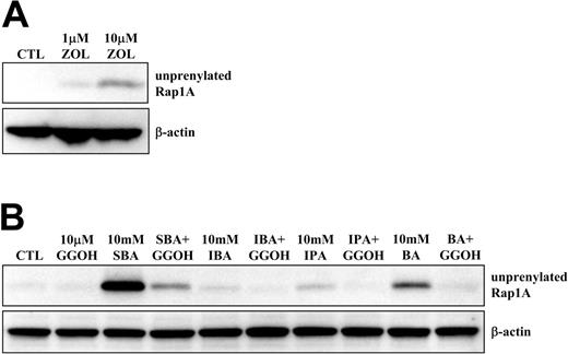 Figure 2. GGOH rescues the inhibition of Rap1A prenylation by alkylamines. PBMCs were treated with (A) 1 or 10 μM ZOL, or (B) 10 mM SBA, IBA, IPA, or BA with or without 10 μM GGOH, for 48 hours prior to Western blot analysis for unprenylated Rap1A and β-actin. Data shown are from one experiment and representative of 2 further experiments from independent donors.
