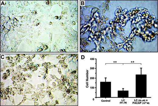 Figure 2. Photomicrograph of cultured human renal proximal tubule cells. (A) Control; (B) proximal tubule cells cultured with 50 μM light chain for 3 days; (C) proximal tubule cells cultured with 50 μM light chain and 1 nM PACAP38 for 3 days. Images were obtained using a Nikon Diaphot inverted phase-contrast microscope (Nikon, Tokyo, Japan) with 10|×/0.30 numeric aperture objective. Images were acquired using a Nikon Coolpix 995 camera and processed using Adobe Photoshop 7 (Adobe Systems, San Jose, CA). (D) Number of healthy cells in each treatment group. Mean and SE of cells in 10 visual fields was used in each group.
