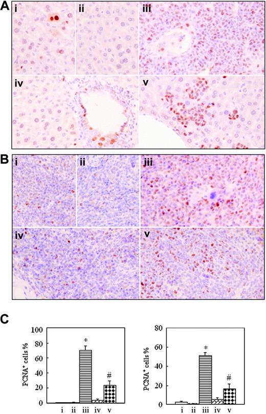 Figure 6. Immunohistochemical detection of proliferating cell nuclear antigen on formalin-fixed, deparaffinized mouse liver and spleen sections. In the same experiments as those described in Figure 2, histopathologic sections of liver (A) and spleen (B) were stained with anti-PCNA antibody as described in “Materials and methods.” Images were observed under a microscope (original magnification × 40/0.75 NA PH2 objective lens). (C) PCNA-positive cell percentages are shown for liver (left) and spleen (right). Each column represents mean of 3 or 4 mice in an independent experiment; error bars represent SD. *P < .001, compared with other groups; #P < .05, compared with mice i, ii, and iv. Symbols i to v represent mice with the same treatment as in Figure 2.