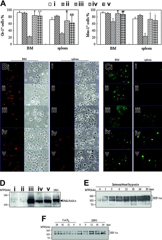 Figure 8. Detection of differentiation-related antigens, PML-RARα, and HIF-1α proteins. (A-D) When leukemic mice in normal oxygen were moribund in the same experiments as those described in Figure 2, all mice were killed and cells from BM and spleen were harvested. (A) Myeloid cells in R1 or R2 region as shown in Figure 3A were analyzed for Gr-1 and Mac-1 expression on flow cytometry. Each column represent the mean percentages of Gr-1+ and Mac-1+ cells of 3 or 4 mice in an independent experiment; error bars represent SD. Compared with leukemic mice in normal oxygen (iii): *P = 6.746 × 10–5, **P = 5.303 × 10–5 for Gr-1+ cells; #P = .002, ##P = .014 for Mac-1+ cells in BM; &P = .023, &&P = .024 for Gr-1+ cells; and P = .002 for Mac-1+ cells in spleen cells. (B-C) Isolated cells were collected onto slides by cytospin and stained, respectively, with anti–mouse Gr-1 (B) and anti–human PML antibodies (C) as described in “Materials and methods.” Immunofluorescence was observed under a microscope (original magnification × 100/1.30 NA oil objective lens). Red staining beside cytoplasms (B) and green staining in the nuclei (C) represent Gr-1 and PML, respectively. (D) Splenocytes from the indicated mice were extracted and PML-RARα proteins were detected by Western blot with NB4 cells as positive control. Symbols i to v represent mice with the same treatment as in Figure 2. (E-F) On the first day after transplantation of leukemic cells, mice were housed into intermittent hypoxia (E), or on the seventh day after transplantation of leukemic cells, mice were treated with 15 μg/g body wt of CoCl2 or 50 μg/g body wt of DFO (F). HIF-1α protein of liver extracts was dynamically detected by Western blots. For panels D-F, equal protein loading was confirmed by Ponceau S staining.