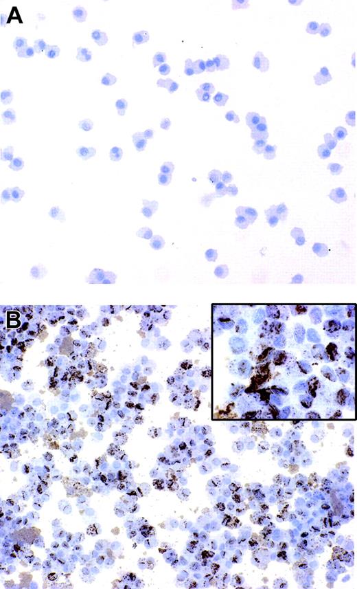 Figure 1. B henselae infects monocyte-derived DCs. DCs untreated or infected with B henselae were stained with anti-BH. No reactivity is detectable in uninfected DCs (A), whereas the majority of infected DCs display a strong positivity (B) with a granular cytoplasmic pattern (B inset). Immunoperoxidase technique for anti-BH counterstained with Meyer hematoxylin. Original magnification, × 200 (A-B) and × 600 (B inset).