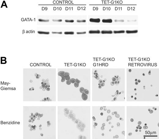 Figure 5. Expression of GATA-1 by the conditional regulation by tetracycline, GATA-1 promoter, and retrovirus vector. (A) Western blot of GATA-1 protein expression at days 9 to 12 of induction after the conditional expression of the Gata-1 gene from day 5. (B) Effects of GATA-1 expression driven by the Gata-1 promoter and by the retrovirus vector on definitive erythropoiesis. May-Giemsa and benzidine staining of EryDs differentiated from control ES cells and TET-G1KO cells at day 12 of induction. TET-G1KO cells were cultured in the presence (100 ng/mL) of tetracycline. G1HRD.GATA-1 and RETROVIRUS show the data for TET-G1KO cells in which GATA-1 was expressed using the Gata-1 promoter and the retroviral vector, respectively.