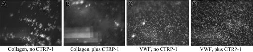 Figure 3. CTRP-1 blocks adhesion of platelets on a collagen type I–coated surface at high shear. CTRP-1 does not affect rolling of platelets on a VWF-coated surface. In A and B, citrated whole human blood was incubated with either vehicle alone (A) or with 20 μg/mL CTRP-1 (B) and was perfused over collagen type I–coated coverslips through a flow chamber at 50 dyne/cm2. In C and D, citrated whole human blood was incubated with either vehicle alone (C) or with 20 μg/mL CTRP-1 (D) and was perfused over VWF-coated coverslips through the flow chamber at 50 dyne/cm2. The pictures shown are the initial frames of brief movies (Videos S1-S4; see the Supplemental Videos link at the top of the online article, at the Blood website) and are representative of repeated experiments.
