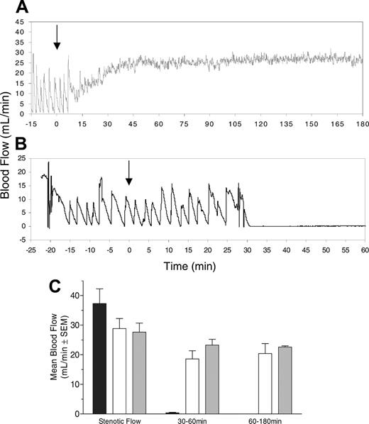 Figure 7. CTRP-1 prevents platelet thrombosis in the nonhuman primate Folts vascular injury model and re-establishes and maintains blood flow. Panels A and B show typical individual flow traces recorded. Treatment with CTRP-1 (0.5 mg/kg) prevents platelet thrombosis and re-establishes blood flow through the injured carotid artery (A). No treatment effect was seen in a BSA-treated control (B). Arrows indicate the time of treatment. (L) The result of the complete study (n = 3, each group; shown is the mean ± SEM). Pretreatment stenotic blood flow was similar in all 3 groups. BSA-treated control animals showed permanent occlusion with no residual blood flow (▪); treatment with 0.5 mg/kg (□) and 1.0 mg/kg CTRP-1 (▦) reestablished blood flow, which was maintained throughout the study. Average blood flow is shown over 2 time intervals: a 30-minute period immediately following cessation of intervention and a subsequent 2-hour time window indicating longer-term effects.