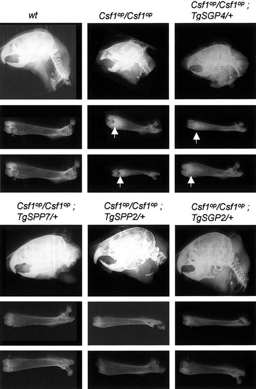 Figure 2. Comparison of the skeletal development of the Csf1op/Csf1op mice expressing varying levels of TgSGP and TgSPP CSF-1. Radiograms of the head and femurs of 2-month-old mice. Each femur is from a different mouse. Vertical arrows indicate regions with increased radiopacity compared with wt mice.