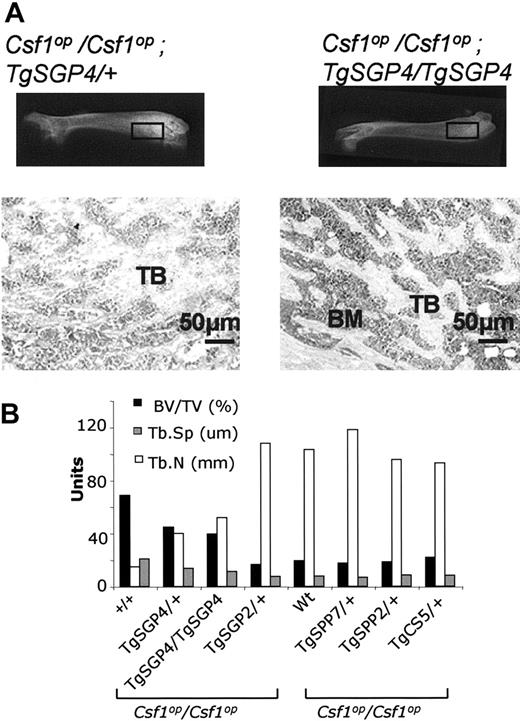 Figure 3. Dosage effect of TgSGP. (A) Comparison of 2-month-old Csf1op/Csf1op; TgSGP4/+ and Csf1op/Csf1op; TgSGP4/TgSGP4 femurs. Top panel: x-ray. Bottom panel: histology of the bone sections. Low-power photomicrographs of comparable fields of 5-μm sections of distal femoral metaphyses stained with H&E. Bar, 50 μm. (B) Histomorphometric analyses of femurs from 2-month-old mice (average from femurs from 2 mice). Dose-dependent correction of skeletal parameters in mice expressing TgSGP but not TgSPP. Also note correction by TgCS. BV/TV indicates bone volume/total volume; Tb.Sp, trabecular spacing; and Tb.N, trabecular number.