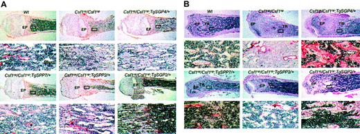 Figure 4. Histology of bone marrow of Csf1op/Csf1op mice expressing varying amounts of TgSPP and TgSGP. Low-power photomicrographs (× 25) above high-power photomicrographs (× 400) (boxed areas in low-power images) of midsagittal 5-μm sections of the distal femoral metaphyses of (A) 1-week-old mice stained for TRAP and counterstained with hematoxylin and (B) 2-month-old mice (top panels stained with H&E; bottom panels, serial sections stained for TRAP and counterstained with hematoxylin). * Osteoclasts; TR, trabecular region; and EP, epiphyseal plate.