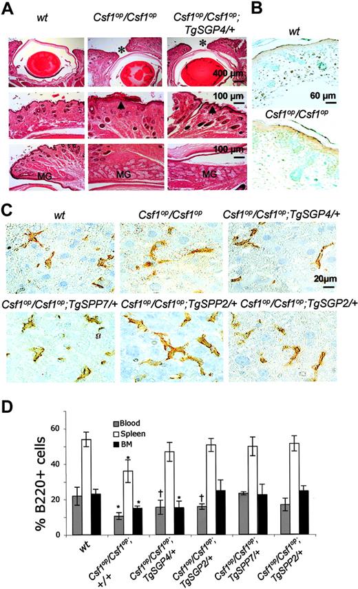 Figure 5. Eyelid opening, macrophage morphology, and B-cell distribution in Csf1op/Csf1op; TgSGP/+ and Csf1op/Csf1op; TgSPP/+ mice. (A) Incomplete eyelid opening in Csf1op/Csf1op and Csf1op/Csf1op; TgSGP/+ mice. H&E staining of eyelids from 6-week-old mice. Top panels: narrow gap between the eyelids marked by an asterisk in Csf1op/Csf1op and Csf1op/Csf1op; TgSGP4/+ mice. Middle panels: chronic active blepharitis with hyperkeratosis marked by arrowhead. Bottom panels: meibomian gland (MG) hyperplasia of the eyelids of these same mice compared with the eyelids of wt mice. (B) Lack of apoptosis in the eyelids of 2-day-old Csf1op/Csf1op mice compared with wt control mice. Brown dots indicate TUNEL-positive cells. (C) Reduced dendritic morphology of F4/80-stained macrophages in 3-month-old Csf1op/Csf1op; TgSGP/+ liver. (D) B220+ cells as a percentage of total white blood cells in blood, spleen, and bone marrow of mice expressing TgSPP and TgSGP on Csf1op/Csf1op background. Data are given as mean ± SD. *P < .05 and †P < .08, for comparison with wt.
