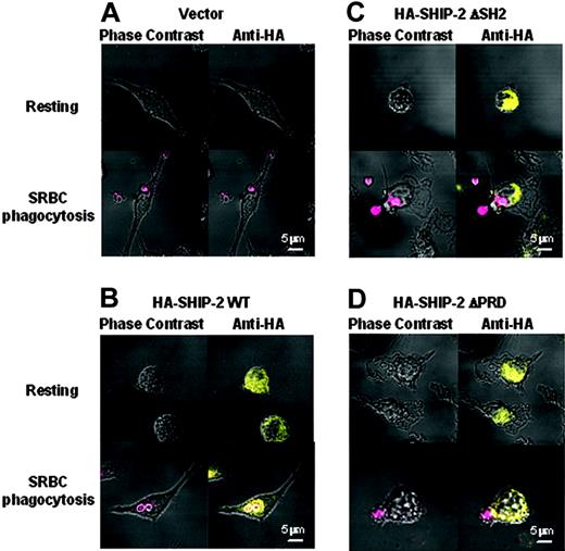 Figure 7. SH2 and PRD domains are both required for translocation of SHIP-2 to the site of phagocytosis. Raw 264.7 cells transfected with HA-tagged SHIP-2 constructs were grown on coverslips and either left untreated (resting) or incubated with IgG-coated SRBCs (red) for 5 minutes at 37°C. Cells were then fixed in 4% paraformaldehyde and permeabilized in 0.2% Triton X-100. After blocking, cells were stained with a mouse anti-HA antibody followed by an Alexa Fluor 594-conjugated goat anti-mouse F(ab′)2 fragment (yellow). Coverslips were mounted on slides and read using Zeiss 510 confocal microscope with ×63 magnification. (A) Empty vector-tranfected cells; (B) HA-SHIP-2 WT transfectants; (C) HA-SHIP-2 ΔSH2 transfectants; and (D) HA-SHIP-2 ΔPRD tranfectants.