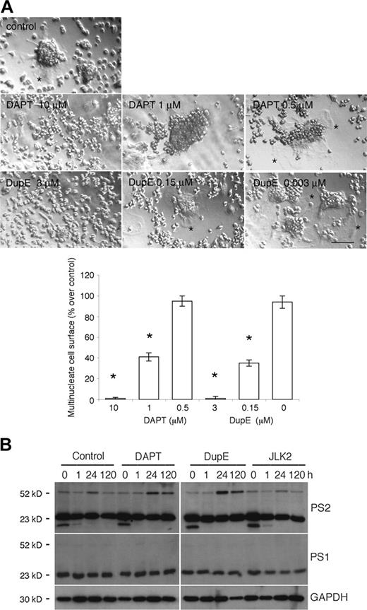 Figure 1. The PS inhibitors DAPT and DupE inhibit the fusion of macrophages and prolong the induced expression of PS2. (A) Rat alveolar macrophages were cultured in fusogenic conditions and treated with increasing concentrations of DAPT or DupE for 3 days. Whereas control cells fused efficiently into multinucleated macrophages, as reflected by the extensive plasma membrane of multinucleate macrophages (*), DAPT and DupE inhibited fusion of macrophages dose dependently, as illustrated by the lack of plasma membrane extension (bar represents 1 mm; *P < .001 versus control; SD; n = 6). (B) Rat alveolar macrophages were cultured in fusogenic conditions in 96-well dishes for the indicated times in the absence or presence of 10 μM DAPT, 3 μM DupE, or 50 nM JLK2. Cells were subjected to Western blotting analysis (0.2 × 106 cells/lane) using antibodies directed against PS1, PS2, or GAPDH. Note that PS1 and PS2 migrated as 23-kDa cleaved amino-terminal fragments, whereas intact PS2 ran as an intact protein of 50 kDa. Also, note the lower molecular weight band of about 15 kDa that is detected in all samples, but at time zero only.