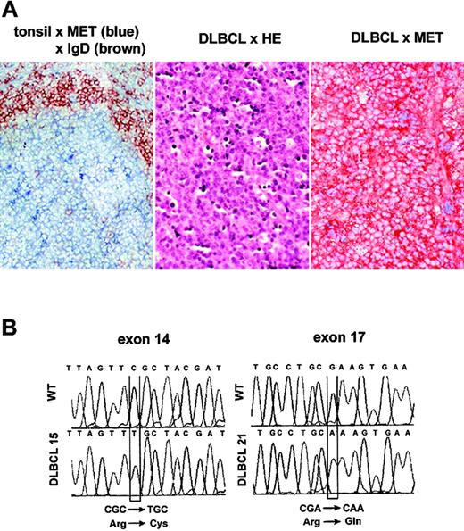 Figure 1. MET expression and missense germ-line MET mutations in DLBCL. (A) MET expression in normal lymphoid tissue and primary DLBCL. Immunohistochemical double staining of tonsillar sections for MET (blue) and IgD (brown), showing MET expression on germinal center B cells (left panel). Frozen tissue sections of DLBCL were stained with hematoxylin-eosin (HE) (middle panel) or with hematoxylin and anti-MET (brown, right panel). Image magnification: × 200. (B) Sequence analysis showing mutational transitions. PCR products were excised, reamplified, cloned, and sequenced. Shown are wild-type (WT) and mutant sequences. Mutational transitions are boxed.