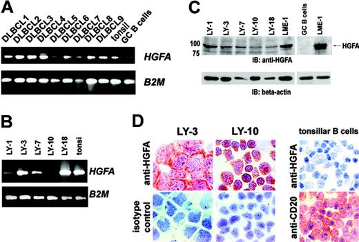 Figure 5. HGFA expression in DLBCL cells. (A) Expression of HGFA in GC B cells and primary DLBCLs at mRNA level. After RNA isolation and cDNA synthesis, RT-PCR for MET was performed. β2-Microglobulin was used as housekeeping gene control. (B) mRNA expression of HGFA in DLBCL cell lines. (C) HGFA protein is expressed in DLBCL cell lines, but not in GC B cells. Cell lysates were immunoblotted using a monoclonal anti-HGFA antibody (A-1). MM cell line LME-1 was used as positive control. β-Actin was used as loading control. (D) Expression of HGFA protein in DLBCL lines and tonsillar B cells by immunocytochemical staining. DLBCL and tonsillar B cells were immunocytochemically stained with mAb A-1 against HGFA (A-1), CD20 (L26), or isotype control, as indicated. Image magnification: × 400.