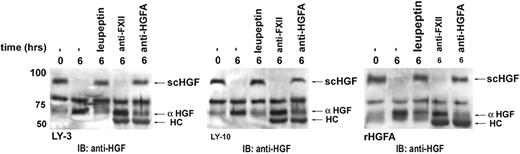 Figure 6. DLBCL cells autocatalyze HGF activation by producing HGFA. Conditioned medium of DLBCL cell lines OCI-LY-3 (left panel) and OCI-LY-10 (middle panel) was incubated with scHGF for 6 hours in the presence of thrombin, combined with either the serine protease inhibitor leupeptin, neutralizing antibody against HGFA (PI-4), or factor XIIa (OT-2), as indicated. As positive control, HGF conversion by recombinant HGFA is shown (right panel). HGF conversion was determined by immunoblotting with anti-HGF. αHGF indicates active α heavy chain of HGF; scHGF, inactive single chain of HGF; and HC, heavy chain of immunoglobulin.