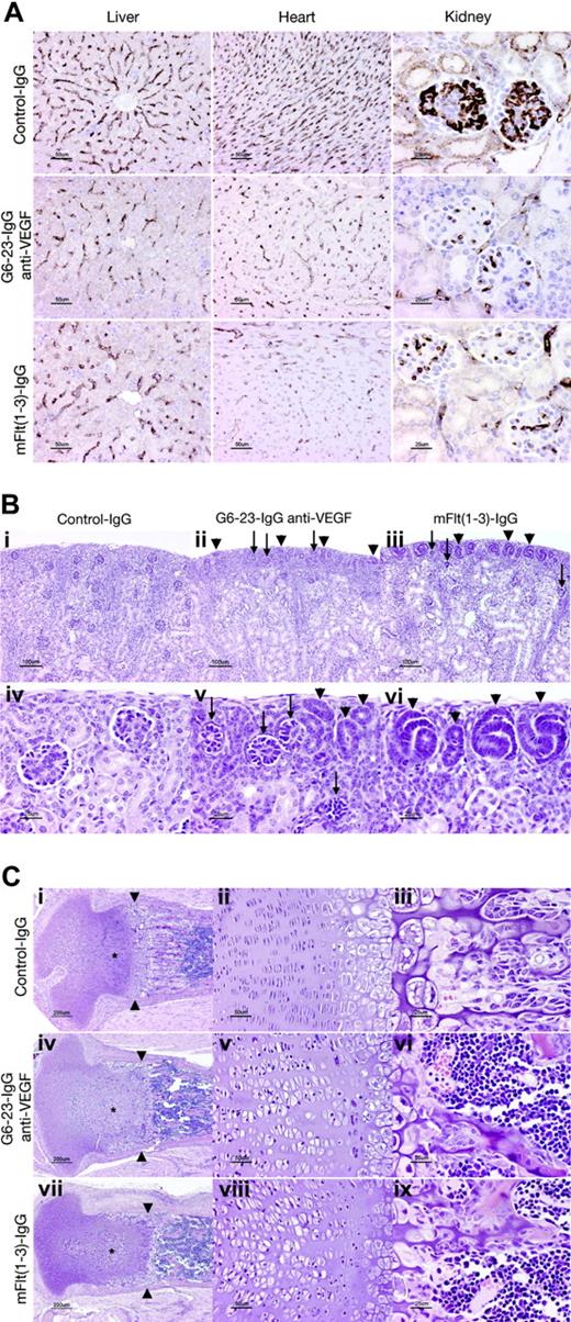 Figure 3. Histopathologic analysis of C57/Bl6 neonatal mice treated for 5 days with G6-23-IgG, mFlt(1-3)-IgG, or control IgG. (A) Assessed vascular density in liver, heart, and kidney. Representative sections stained with rat anti–mouse VEGFR-2 antibody from each treatment group are illustrated. Vessel density was reduced to a similar extent by mFlt(1-3)-IgG and G6-23-IgG in all organs (see Table 2 for quantitative assessment). (B) Delayed and abnormal glomerular maturation in anti-VEGF–treated kidneys. Control glomeruli (iv) all have identifiable capillary loops supported by mesangial cells. Anti-VEGF treatment results in delayed glomerular maturation; persistent nephrogenic precursors including ureteric tubules and glomerular precursors are indicated with arrowheads (ii, iii, v, vi). Maturation appears more delayed in mFlt(1-3)-IgG– than G6-23-IgG–treated animals. Abnormal glomerular “rosettes” (ii, iii, v; arrows) are composed of podocytes surrounding largely avascular mesangial cores. (C) Alterations in the cartilaginous growth plate of anti-VEGF–treated animals. G6-23-IgG and mFlt(1-3)-IgG treatment results in expansion of proliferating chondrocytes (asterisks; compare control subpanel i with panels iv and vii). Subpanels ii, v, and viii show details of the proliferating chondrocyte zone, illustrating expansion of the lacunae of individual cells. Width of hypertrophic chondrocyte zone (arrowheads) is reduced in anti-VEGF–treated animals.