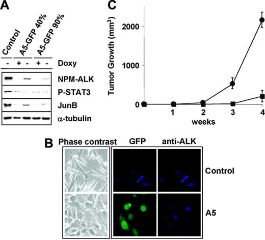 Figure 2. ALK siRNA reverts NPM-ALK–mediated transformation of MEF cells in vitro and in vivo. (A) Suppression of NPM-ALK expression leads to down-regulation of known downstream targets of ALK. Lysates from NPM-ALK Tet-Off MEFs infected with pSRG-A5 virus (semiconfluent cells in absence of doxycycline) before (40% EGFP+) or after (> 90% EGFP+) puromycin selection were immunoblotted with the indicated antibodies. (B) NPM-ALK MEF cells lose their transformed phenotype in absence of NPM-ALK expression. Cell cultures in absence of doxycyline are rescued from the ALK-mediated transformed phenotype by the expression of ALK-A5 shRNA (contrast phase microscopy, left panels). Control and pSRG-A5–infected NPM-ALK Tet-Off MEF cells were stained with anti-ALK antibodies, followed by biotin-conjugated horse antimouse antibody and streptavidin-Cy3. Cells were counterstained with Hoechst 33258 and visualized with a Leica fluorescence microscope using a 63× objective (right panels). (C) pSRG-A5 expression prevents NPM-ALK MEF cell growth in immunocompromised mice. NPM-ALK Tet-Off MEF cells transduced with pSRG-A5 or control pSRG were first selected with puromycin (> 90% EGFP+), inoculated (106 cells/mouse) subcutaneously into athymic Nu/Nu mice recipients (3 mice for each construct). • indicates pSRG; ▪, pSRG-A5. Tumor growth was monitored over time. These findings are representative of 2 experiments. Error bars indicate SD.