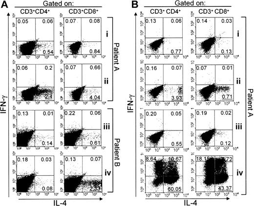 Figure 2. Effector T cells with a TH2/Tc2 phenotype at tumor site of patients with B-NHL. (A) Intracellular staining for IL-4 and IFN-γ production in gated CD4+ or CD8+ T cells isolated from involved lymph nodes of two patients with FL (A and B). Lymphocytes from patient A were tested without prior activation against autologous DCs either unloaded (i) or loaded with killed autologous B-cell tumor (ii). Lymphocytes from patient B were tested without prior activation either alone (iii) or against live autologous B-cell tumor (iv). (B) Lymphocytes from patient A, isolated from the same lymph node as in panel A, were cultured for 2 weeks with DCs loaded with killed autologous B-cell tumor and then tested either alone (i) or against live autologous B-cell tumor (ii), allogeneic B-cell tumor (iii), or after activation with PMA + ionomycin (iv). Numbers in the dot plots indicate the fraction of positive cells in each quadrant.