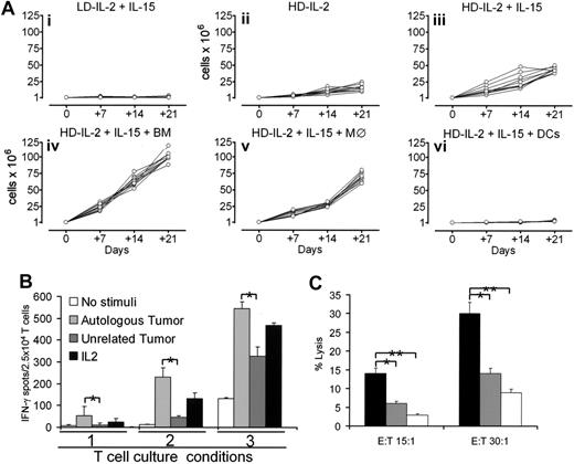 Figure 5. Growth and functional analysis of T cells from patients with B-cell NHL after culture with γc cytokines. (A) Purified CD3+ T cells from tumor-containing lymph nodes of 10 patients with B-NHL were seeded at the initial concentration of 1 × 106/mL and cultured for 3 weeks with autologous B-tumor cells in the presence of IL-2 at 3 ng/mL (LD–IL-2) or at 300 ng/mL (HD–IL-2). IL-15 was used at 10 ng/mL. Irradiated autologous bone marrow–derived cells (BM), autologous monocytes (MØ), or autologous monocyte-derived DCs (DCs) were also added in some cultures. Total number of viable cells was assessed by trypan blue exclusion and the number of CD3+ cells by immunophenotyping on days 0, 7, 14, and 21 of culture. Viable cells were always greater than 97% CD3+ T cells. (B) T cells isolated from tumor-containing lymph nodes were cultured for 3 weeks with HD–IL-2 alone (1), or HD–IL-2 plus IL-15 (2), or HD–IL-2 plus IL-15 and irradiated autologous bone marrow–derived cells (3). The T-cell cultures were then evaluated in a 24-hour IFN-γ–ELISPOT assay in response to no stimulus (white bars, negative control), autologous (light gray bars), or allogeneic (dark gray bars) B-cell tumor, or IL-2 at 300 ng/mL (black bars, positive control). (C) T cells were cultured with HD–IL-2 plus IL-15 and autologous bone marrow–derived cells and then tested for lysis of autologous B-cell tumor preincubated (empty bars) or not (black bars) with a mAb to a monomorphic determinant of HLA class I antigens. T cells were also tested for lysis of an allogeneic HLA-mismatched B-LCL (gray bars). (B-C) Error bars indicate SD of the mean. Statistical analysis was annotated as follows: *P < .05, **P < .01.