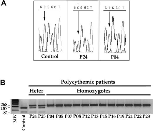 Figure 2. Detection of the C598T mutation in DNA samples from 2 heterozygotes and 12 homozygotes. (A) Examples of sequences of the relevant region of the VHL gene in a control subject, in a heterozygote (P24), and in a homozygote (P04) patient. (B) FnU4HI digested the 268-bp PCR product of the wild-type VHL allele into 187- and 81-bp bands. Conversely, the C598T mutation resulted in an uncut 268-bp band. Patients P24 and P25 were heterozygotes for the mutation, whereas the other patients are homozygotes. MW indicates molecular weight standards; Heter, heterozygotes.