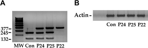 Figure 3. VHL expression in lymphoblastoid cells from a control subject (Con), 2 heterozygotes (P24 and P25), and a homozygote (P22). (A) Total RNA from each cell line was retrotranscribed to cDNA, which was amplified as reported in “Patients, materials, and methods,” and the product (377 bp) was digested with FnU4HI. The normal allele yielded 2 fragments of 245 bp and 132 bp. The C598T mutation abolished the restriction site and resulted in an uncut 377-bp band. The 2 heterozygote patients (P24 and P25) expressed the allele in roughly similar amounts. Conversely, the homozygote for the VHL mutation shows a single undigested band. (B) The expression of the actin gene served as control.