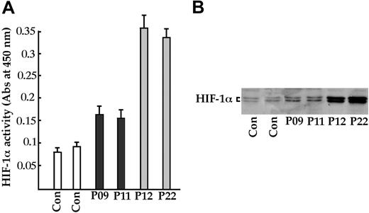 Figure 4. HIF-1α activity in lymphoblastoid cell lines. (A) Samples from 2 control subjects (Con), 2 healthy heterozygotes (P09 and P11), and 2 homozygotes (P12 and P22) were cultured, and nuclear extracts were assayed for HIF-1α activity with the TransAM HIF-1 kit (Active Motif) and (B) with immunoblotting with the antibody in the TransAM HIF-1 kit. Error bars indicate 2 SDs.