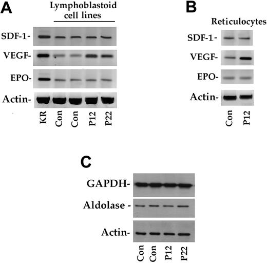 Figure 5. HIF-1α–dependent expression in lymphoblastoid cell lines and reticulocytes. (A) Total RNA from lymphoblastoid cells of 2 control subjects (Con) and 2 homozygote patients (P12 and P22). Kidney total RNA (KR) was used as a positive control. Expression of the actin gene served as a control. (B) Total RNA from the reticulocytes of a control and a homozygote patient (P12) were used as starting material. (C) Immunoblotting analysis of aldolase and GAPDH in cellular extracts of 2 control subjects and 2 homozygotes (P12 and P22). See “Patients, materials, and methods” for further details.