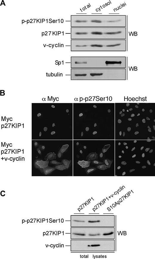Figure 5. Ser10-phosphorylated p27KIP1 is predominantly cytoplasmic in PEL cells. (A) BC-3 cells were separated into cytoplasmic and nuclear extracts as described in “Materials and methods.” The resulting fractions were resolved on SDS-PAGE (12%) and analyzed by immunoblotting with anti-p-p27 (Ser10), anti-p27KIP1, and anti-v-cyclin antibodies (top 3 panels). The distribution of the nuclear marker Sp1 and the cytoplasmic marker β-tubulin confirmed the purity of the fractions (bottom 2 panels). (B) U2OS cells were transfected with expression vector for Myc-p27KIP1 alone or together with v-cyclin. Cells were analyzed 48 hours after transfection by indirect immunofluorescence. The cells were labeled by anti-Myc and anti-p-p27KIP1 Ser10 antibodies as indicated and their nuclear morphology was visualized by Hoechst staining. (C) U2OS cells were transfected with expression vector for Myc-p27KIP1 alone or together with v-cyclin or with S10A-p27KIP1 alone. Total-cell lysates of transfected cells were resolved by SDS-PAGE (12%) and immunoblotted with anti-p-p27 (Ser10), anti-p27KIP1, and anti-v-cyclin antibodies as indicated (WB).