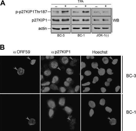 Figure 7. Lytic reactivation of KSHV leads to down-regulation of p27KIP1 in PEL cells. (A) BC-3, BC-1, and JOK-1 (a KSHV-negative control cell line) cells were either treated with TPA or with DMSO (noninduced control) for 24 hours. Whole-cell extracts were resolved by 12% SDS-PAGE and analyzed by immunoblotting with antibodies against p-p27 (Thr187), p27KIP1, and actin (loading control). (B) BC-3 and BC-1 cells were induced to viral replication with TPA for 48 hours. The p27KIP1 down-regulation in anti-ORF59-positive cells was determined by double-label immunofluorescence experiment after cytocentrifugation. Arrowheads point to ORF59-positive cells with down-regulated p27KIP1.