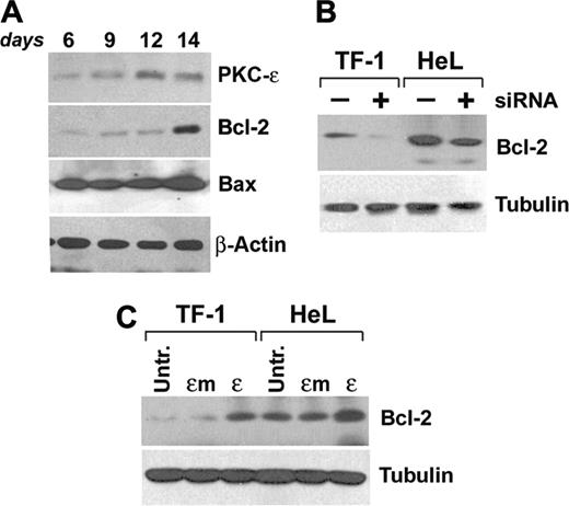 Figure 6. PKCϵ modulates Bcl-2 levels. (A) CD34-derived erythroblasts were cultured with IL-3, SCF, and EPO up to 14 days and total Bcl-2, PKCϵ, and Bax protein expression levels were monitored at the indicated times by Western blot. (B) Western blot of Bcl-2 in TF-1 and HeL cell lines in the presence (+) or absence (–) of PKCϵ-specific siRNA. (C) Western blot of Bcl-2 in TF-1 and HeL cell lines overexpressing wild-type (ϵ) or mutated (ϵm) PKCϵ.