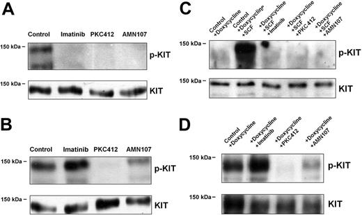 Figure 1. Effects of TK inhibitors on KIT phosphorylation in neoplastic cells. (A-B) KIT phosphorylation in HMC-1.1 cells (A) and HMC-1.2 cells (exhibiting KIT D816V) (B) after incubation in control medium, imatinib (1 μM), PKC412 (1 μM), or AMN107 (1 μM) for 4 hours. (C-D) KIT phosphorylation in Ton.Kit.wt cells (C) and Ton.Kit.D816V.27 cells (D) after incubation in control medium (control), imatinib (1 μM), PKC412 (1 μM), or AMN107 (1 μM) for 4 hours. Prior to drug exposure, Ton.Kit.wt cells and Ton.Kit.D816V.27 cells were kept in doxycycline for 24 hours to induce expression of KIT. In case of the Ton.Kit.wt clone, cells were also exposed to SCF (100 ng/mL, 4 hours) to induce KIT phosphorylation (p-KIT). In all cells, immunoprecipitation was conducted using the anti-KIT mAb SR-1. Western blotting was performed using the antiphospho mAb 4G10 for p-KIT detection and the anti-KIT mAb 1C1 for detection of total KIT protein.