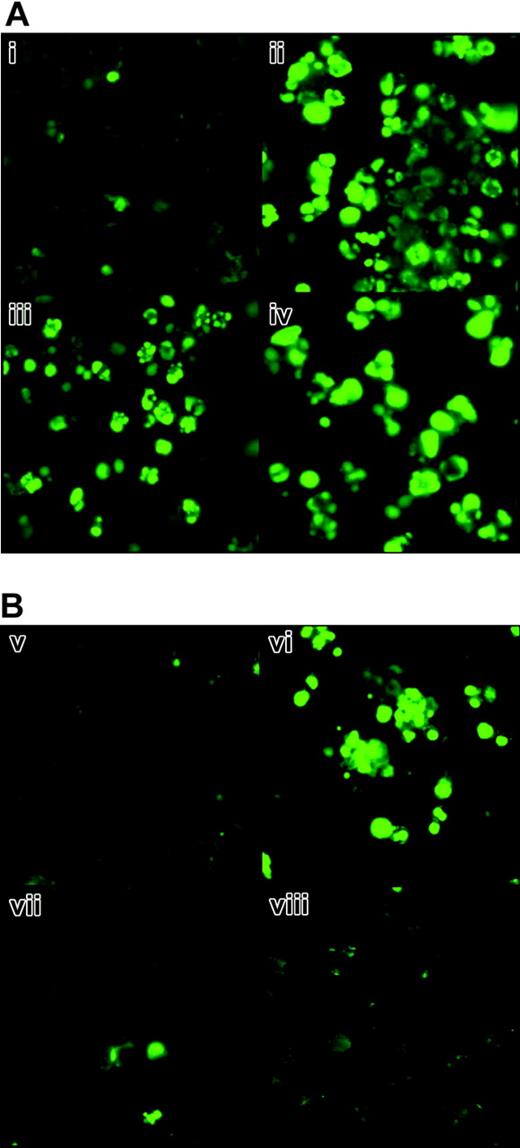 Figure 5. Apoptosis in HMC-1 cells assessed by TUNEL assay. HMC-1.1 cells (A) and HMC-1.2 cells (B) were incubated in control medium (i,v), PKC412, 1 μM (ii,vi), AMN107, 1 μM (iii,vii), or imatinib, 1 μM (iv,viii) at 37°C for 24 hours. Thereafter, cells were harvested and subjected to TUNEL assay. As visible, PKC412 produced apoptosis in most HMC-1.1 and HMC-1.2 cells, whereas AMN107 and imatinib showed potent apoptosis-inducing effects in HMC-1.1 cells (iii-iv), but not in HMC-1.2 cells exhibiting KIT D816V (vii-viii). Images were obtained using a Nikon Plan Apo 40 ×/1.0 numeric aperture oil objective. Images were acquired from FITC-labeled cells using a Hamamatsu high-resolution digital camera (model C4242-95; Hamamatsu, Japan) and HPD-CPX32 Microsoft Windows 95 software (Microsoft, Redmond, WA). Citifluor (Agar Science, Stansted, United Kingdom) was used as imaging solution.