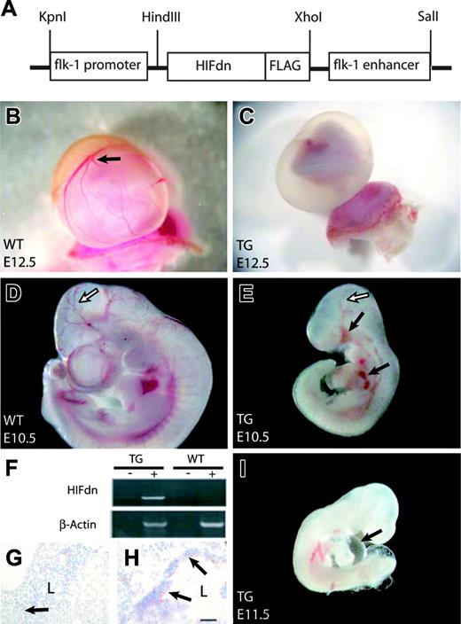 Figure 2. Generation of Flk1 p/e–HIFdn transgenic embryos. (A) Expression vector for the generation of HIFdn transgenic mouse embryos. (B) Well-vascularized yolk sac of a wild-type embryo at E12.5 (arrow indicates branching vessels). (C) The yolk sac of a transgenic littermate was not perfused and lacked large vessels. (D) Wild-type embryo at E10.5 with well-organized cephalic vascular tree (arrow). (E) HIFdn transgenic embryos at E10.5 were growth retarded, had a disorganized vasculature (open arrow), and showed hemorrhages (filled arrows). (F) In transgenic embryos, HIFdn was detected by RT-PCR in the RT reaction (+) but not in control reaction without reverse transcriptase (–). (G-H) FLAG-tagged HIFdn was detected by immunohistochemistry in blood vessels of transgenics (H, arrows) but not in vessels of wild-type embryos (G, arrow). L indicates vessel lumen; bar, 50 μm. (I) Transgenic embryos at E11.5 displayed pericardial edema (arrow). Magnification: 8 × (B,C), 12 × (D,E,I).