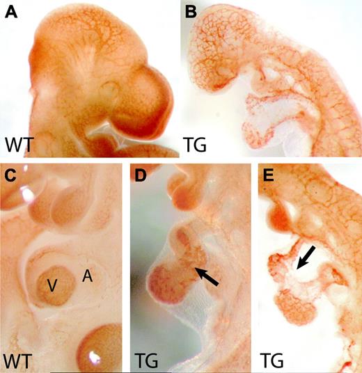 Figure 3. Vascular disorganization in Flk1 p/e–HIFdn transgenic mice. Whole-mount immunohistochemistry for PECAM-1. (A) Wild-type embryo at E10.5 with well-developed vessel system. (B) The cephalic vasculature in transgenic littermates remained a primitive plexus. (C) Higher magnification of a wild-type heart. V indicates ventricle; A, atrium. (D-E) Transgenic hearts were not properly looped but remained linear tubes. The endocardium was patchy and irregularly shaped (arrows). Magnification: 32 × (A,B), 50 × (C,D,E).