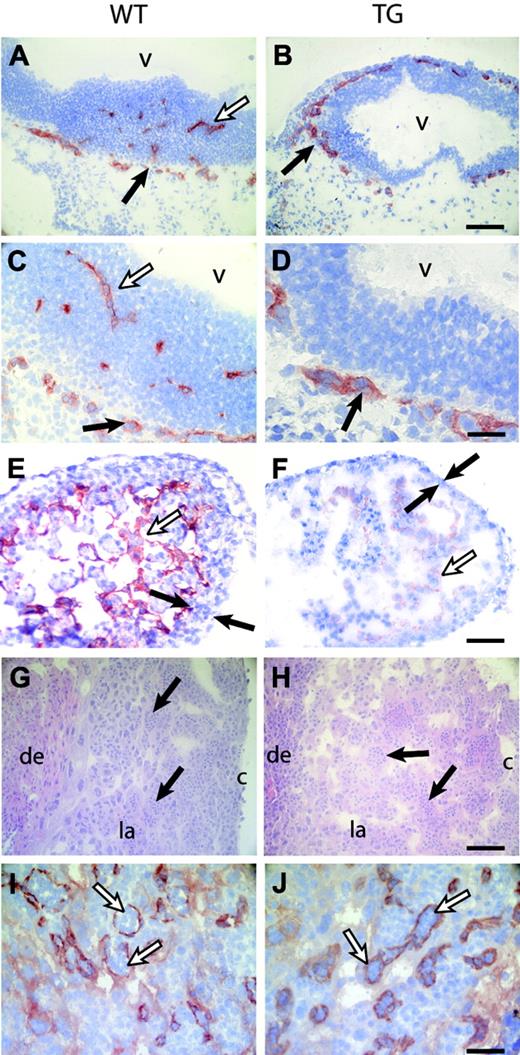 Figure 4. Defects in angiogenesis and heart development in Flk1 p/e–HIFdn transgenic embryos. Immunohistochemistry for PECAM-1 (except for panels G-H). (A-D) Sections of the head region at E10.5. (A,C) The PNV was formed in wild-type embryos (filled arrows), and vessels invaded the neuroepithelium (open arrows). (B,D) In transgenic embryos, the PNV was formed (arrows) but failed to sprout into the neural tissue. (E) Ventricles of the heart consisted of multiple layers of myocytes (filled arrows) and trabeculae lined with endothelial cells (open arrow) in wild-type embryos at E11.5. (F) HIFdn transgenic embryos had a thin myocard (filled arrows), poorly established trabeculation, and disorganized endocardium (open arrow). (G-H) Hematoxylin and eosin (H+E) staining of placentae at E10.5. Embryonic vessels were filled with primitive nucleated erythrocytes (arrows). (I-J) PECAM-1 staining revealed endothelial cells of embryonic vessels in the labyrinthine layer (arrows). The degree of vascularization was equal in wild-type and transgenic placentae. v indicates brain ventricle; de, maternal deciduas; la, labyrinthine layer; c, chorionic plate. Bars in panels B,F,H, 100 μm; panels D,J, 50 μm. Magnification in panels A, C, E, G, and I is the same as in panels B, D, F, H, and J, respectively.