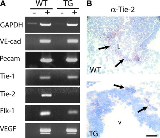 Figure 5. Reduced Tie-2 expression in Flk1 p/e–HIFdn transgenic embryos. (A) RNA was isolated from wild-type (WT) and transgenic (TG) embryos at E10.5. RT-PCR (+) and a control reaction without RT (–) were performed. No difference in the transcription levels of VE-cadherin, PECAM-1, Tie-1, or VEGF was observed. Flk-1 mRNA was reduced in transgenic embryos, and Tie-2 was below detection level after 35 PCR cycles (n = 4). (B) Immunohistochemistry of embryo sections. Tie-2 was detectable in endothelial cells of wild-type embryos (arrows, top panel) but was absent from vessels in transgenic littermates (arrows, bottom panel). v indicates brain ventricle; L, lumen. Bar in panel B, 50 μm.