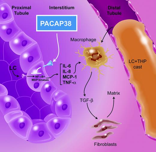 Following glomerular ultrafiltration, immunoglobulin light chains (LCs) bind to a receptor on the apical surface of proximal tubule epithelial cells and undergo endocytosis. Through a process not yet understood, NF-κB and the MAP kinase pathways are activated, resulting in production of chemokines and cytokines that include IL-6, IL-8, MCP-1, and TNF-α. Local production of these chemoattractants results in renal interstitial inflammation, TGF-β activation, and matrix protein production by fibroblasts. In the distal nephron, LC coprecipitates with Tamm-Horsfall protein (THP) to produce an intraluminal cast that obstructs tubule fluid flow and produces breaks in the epithelial cell lining, compounding the interstitial scarring. PACAP38 prevents the activation of the proximal tubule epithelium by LC and inhibits production of TNF-α and IL-6. Illustration by A. Y. Chen.