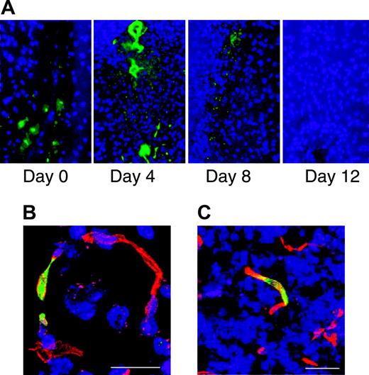Figure 5. Bone marrow-derived cells incorporate into the repairing vasculature in the injured brain. Stab injury to the brain was performed on Swiss mice. Zero to 12 days after injury the mice were injected intravenously with FITC-labeled albumin and perfused with PBS 10 minutes after injection. Sections through the area of brain injury show leakage of FITC-labeled albumin from the vasculature that is no longer evident by day 12 (A). Bone marrow transplantations were performed on SCID mice using marrow from FVB/N-TgN (Tie2-LacZ)182 Sato mice that express β-galactosidase specifically in endothelial cells. One month after transplantation, stab injury of the brain was performed. Three to 5 days after the injury the animals were killed and sections through the injured area were stained with anti-β-galactosidase (green) and the endothelial marker CD31 (red). Fluorescence microscopy shows incorporation of β-galactosidase-expressing cells into the repairing vasculature. Scale bars represent 20 mm (B) and 100 mm (C).