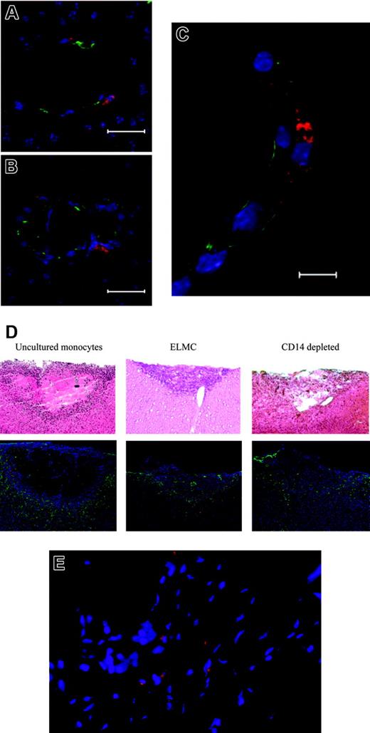 Figure 6. ELMCs participate in vascular repair after brain injury. Stab brain injury was performed on SCID mice and DiI-labeled ELMCs were administered to mice via tail vein 24 hours after injury. Three to 5 days later the mice were killed and sections through the area of injury were stained for the endothelial markers CD105 and ZO-1. DiI-labeled ELMCs (red) and vascular endothelial cells stained with CD105 (green) in panels A and B and ZO-1 (green) (C) are shown. Labeled ELMCs can be seen in a perivascular location. Scale bars are 20 mm (A, B) and 10 mm (C). ELMCs are located at the periphery of the injury site in a cold brain injury. Cold injury was performed on SCID mice. DiI-labeled human ELMCs, freshly isolated CD14+ monocytes, or CD14-depleted peripheral blood mononuclear cells were injected via tail vein 24 hours after injury. Mice were killed 5 days after injury and sections were stained for glial fibrillary acidic protein (GFAP) (D). Hematoxylin and eosin (H&E) sections of the corresponding injury site are shown for comparison (D). Red-labeled uncultured monocytes and ELMCs can be seen at the periphery of the injury site. CD14-depleted cells are not present. Reactive astrocytes around the injury site are stained with GFAP (green). ELMCs will localize to injuries at non-CNS sites. Skin punch biopsy was performed on the backs of SCID mice. DiI-labeled ELMCs were administered to mice via tail vein 24 hours after injury. Five days after injury the mice were killed and sections through the area of injury were obtained. DiI-labeled ELMCs (red) (E). Nuclei are labeled with DAPI.
