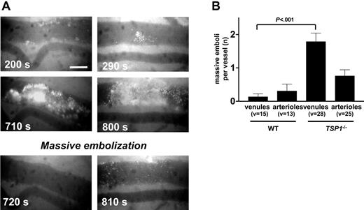 Figure 7. Embolization of Tsp1-/- platelet thrombi. (A) Examples of thrombus formation and sudden embolization (as indicated by the time in seconds) of large thrombi after intestinal venule damage in Tsp1-null mice. Scale bars represent 50 μm. (B) Mean number (± SEM) of embolization cycli before occurrence of occlusion in venules and arterioles of WT and Tsp1-null mice for the number of vessels indicated (v). P values were calculated via nonparametric Mann-Whitney test, with 2-tailed P value (*P < .001 between mean number of embolizations in WT and TSP-1-null mice).