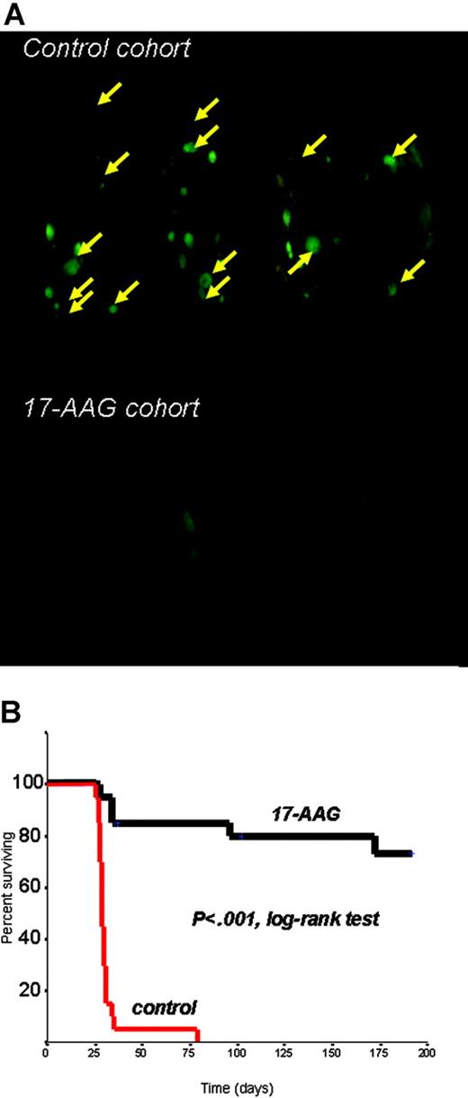 Figure 2. In vivo anti-myeloma activity of hsp90 inhibition. (A) Representative results of whole-body fluorescence imaging of SCID/NOD mice injected intravenously with 5 × 106 RPMI-8226/S-GFP+ human MM cells and receiving either 17-AAG treatment or vehicle. Imaging results obtained 4 weeks after intravenous injection of GFP+ MM cells indicate extensive diffuse GFP+ bone lesions (arrows) in the spine, skull, lower extremities, and pelvis, as well as subcutaneous GFP+ lesions in the control cohort, in marked contrast to the absence of MM lesions in 17-AAG-treated mice. (B) Kaplan-Meier survival curve of 17-AAG-treated vs. control SCID/NOD mice injected intravenously with RPMI-8226/S-GFP+ cells. 17-AAG treatment significantly prolonged median overall survival of mice (> 250 days, with 14/20 of 17-AAG-treated mice surviving at the last interim analysis, vs 29 days median overall survival for control mice, with 0/20 mice surviving) (P < .001, log-rank test).