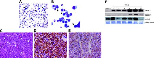 Figure 2. Mice receiving transplants with TEL2-BM develop a chronic myelomonocytic-like disease. (A) Peripheral blood smear stained with May-Grünwald-Giemsa (MGG) of a diseased mouse that underwent TEL2-BM transplantation. Arrows indicate blastlike cells. (B) Cytospin preparation after MGG staining of bone marrow of a diseased mouse that underwent TEL2-BM transplantation, showing an excess of myeloid cells in early stages of differentiation. Arrows indicate blast cells. (C) Spleen—of a diseased mouse that underwent TEL2-BM transplantation—with an extensive red pulp infiltrate of myeloid cells with a high mitotic index (H&E, magnification × 40). Mitotic figures are indicated by white arrowheads. (D) The myeloid cells expressed GFP (brown stain), confirming their transplant derivation (anti-GFP, magnification × 40). (E) The myeloid population was primarily composed of immature cells that expressed MPO (brown stain), consistent with their granulocytic lineage (anti-MPO with cytoplasm localization, magnification × 40). (F) Top row shows a Western blot analysis of TEL2 expression in spleen samples of 1 MSCV-BM (MSCV, 10 months after transplantation) and 6 diseased TEL2-BM mice at the moment of death. The second row shows Bcl-xl and Bcl-xs expression in the same samples. Bcl-xl and Bcl-xs expression in leukemic spleen samples is not altered compared with that in the control spleen sample. The third row shows that 4 of 6 leukemic TEL2 spleens show increased Bcl2 expression (samples 1, 3, 4, and 5). The bottom row shows protein loading of the blot after staining with Coomassie blue.
