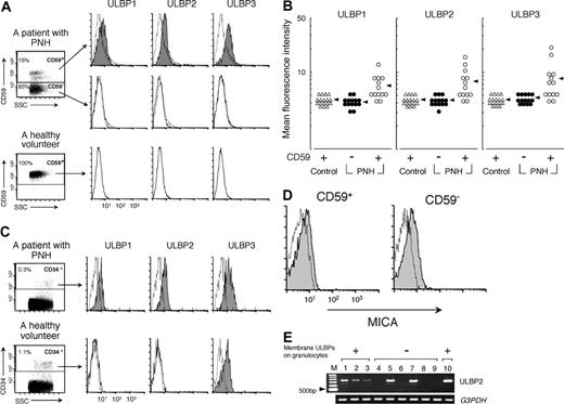Figure 5. Expression of ULBP on the blood cells of patients with PNH. (A) Flow cytometry revealed the expression of ULBPs 1-3 on GPI+ granulocytes (shaded histograms) of a patient with PNH (patient no. 1 in Table 1) but on neither his GPI- granulocytes nor control granulocytes of a healthy volunteer. (B) Expression profiles of ULBPs were summarized in 14 PNH patients (PNH: ○, CD59+; •, CD59-) and 17 healthy volunteers (Control, ▵). Arrows indicate the average of mean fluorescence intensities in each population. (C) ULBPs 1-3 were expressed on CD34+ BM cells (shaded histograms) of a patient with PNH (patient no. 10 in Table 1). 87% of the cells were positive for CD59. Only ULBP3 was detected on the BM cells of a healthy volunteer. Dotted lines show nonspecific background staining with isotype-matched control Ig. (D) Expression of MICA on CD59+ and CD59- granulocytes (shaded histograms) of a patient with PNH (patient no. 9 in Table 1) who had granulocytes expressing membrane ULBPs. (E) Expression of ULBP2 mRNA in granulocytes of 7 patients with PNH (lanes 1-7) and 2 healthy donors (lanes 8 and 9). Lanes 1-3 show patients with PNH having granulocytes expressing membrane ULBPs; lanes 4-7, PNH patients having granulocytes lacking membrane ULBPs. M indicates 100-bp DNA ladder; lanes 1-7, patient nos. 2, 3, 4, 7, 10, 12, or 6 in Table 1; lane 10, K562 cells; and G3PDH, glyceraldehyde 3-phosphate dehydrogenase. Dotted lines in panels A, C, and D indicate nonspecific background staining with isotype-matched control Ig.