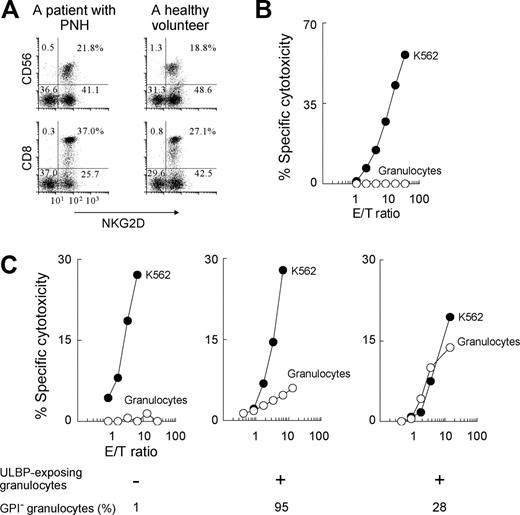 Figure 6. Killing of granulocytes by autologous cytotoxic cells of patients with PNH. (A) 2-color flow cytometry showed that both CD56+ and CD8+ cells expressed NKG2D in a representative patient with PNH (patient no. 1 in Table 1) and a healthy volunteer. Dotted lines show nonspecific background staining with isotype-matched control Ig. The percentages of cells in each quadrant are indicated. (B-C) Killing of granulocytes (○) and K562 cells (•) was assessed by 4-hour cytotoxicity assay with autologous PBMCs. (B) Representative of 4 healthy donors. (C) Left panel, representative of 3 PNH patients not having granulocytes with membrane ULBPs; middle and right panels, representatives of 5 patients with PNH having granulocytes with membrane ULBPs. Only the patients with ULBP+ cells also had MICA+ cells, whereas the patients without ULBP+ cells did not. E/T ratio indicates NK cells in PBMCs-target cells (K562 cells or isolated granulocytes).